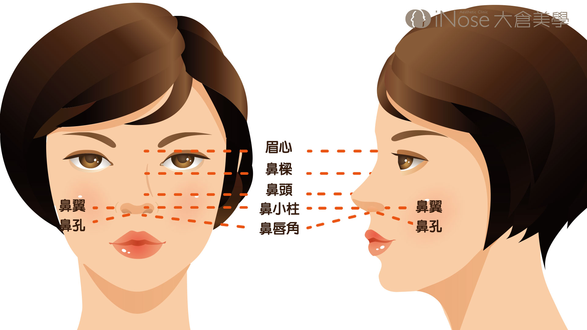7段結構式隆鼻 全臉自體脂肪補脂 隆鼻費用 隆鼻後遺症 自體脂肪補臉 七段式插圖