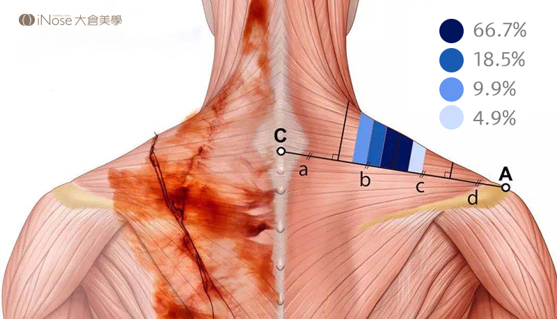 瘦肩針官網圖 4 2