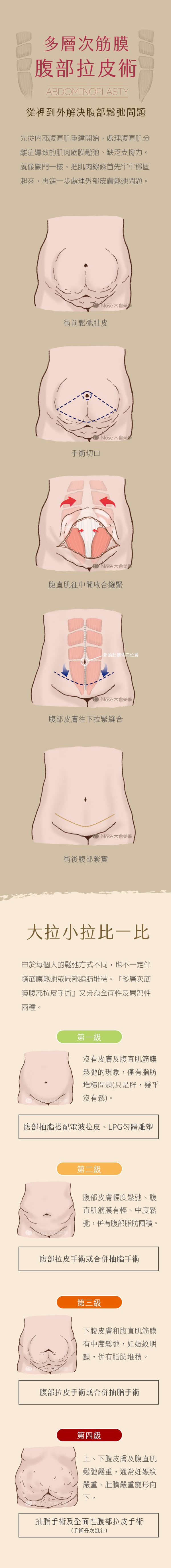 多層次筋膜腹部拉皮官網圖3